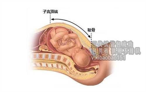 上海供卵试管婴儿代怀,上海代怀一个男孩多少钱,y精子和x精子谁游得快受孕更
