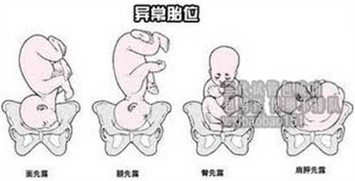 上海试管代怀生个男孩,北京代怀孕如何拟标题,试管孩子有什么缺陷是普通孩子