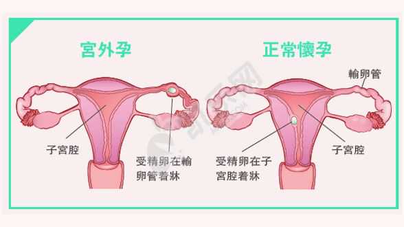 南京代怀孕2022价格,北京代怀孕晴天代怀孕,试管18个卵泡受孕成功率多少？